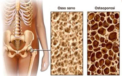 Osteoactive - originale - in farmacia - Italia