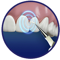 DentaPulse - come si usa - funziona