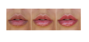 Vip's Lips - come si usa - ingredienti - composizione - funziona