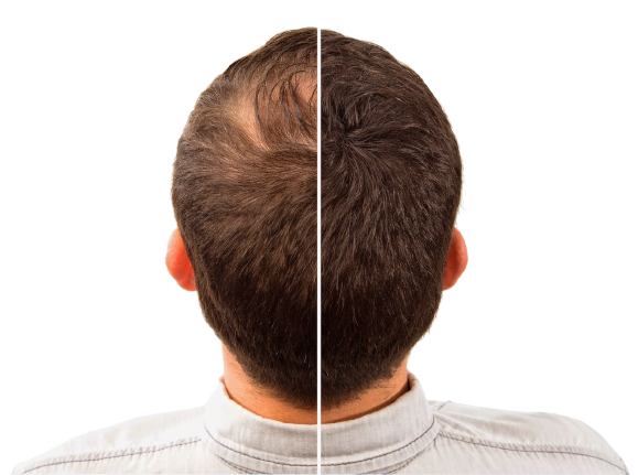 Hair Intense - effetti collaterali - controindicazioni