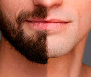 Beard Trimmer - prezzo - amazon - dove si compra