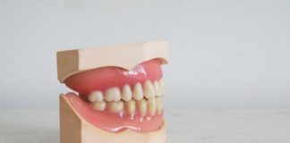 Dente rotto cosa fare quando un dente è rotto o scheggiato
